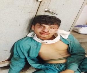 کراچی  میں سپر ہائی وے جمالی پل کے قریب  شہریوں نے مبینہ ڈاکو   کو پکڑلیا۔ خوب درگت بنانے کے بعد پولیس کے حوالے  کردیا۔