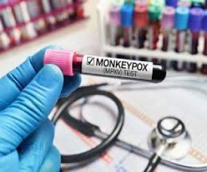 منکی پاکس کے مشتبہ مریض اسلام آباد   ایئرپورٹ سے اسپتال منتقلی کے دوران فرار،