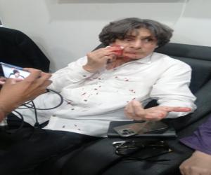 اسلام آبادسیکٹرجی سیون میں تحریک انصاف رہنمارؤف حسن پرخواجہ سراؤں کاحملہ